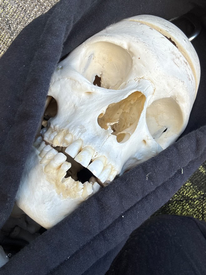 bbf2832f 9607 499c 9abc 8971676cfb14